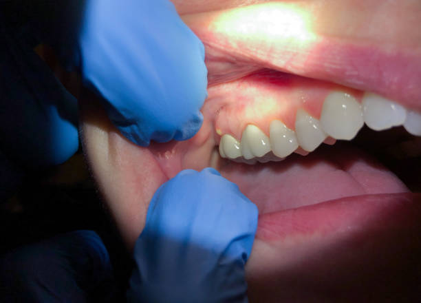 Emergency Dentist Open Today in VA